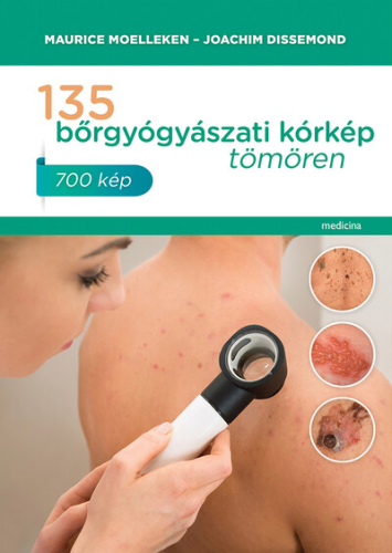135 bőrgyógyászati kórkép tömören